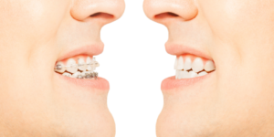 Complete Guide to Orthodontics in the United Kingdom